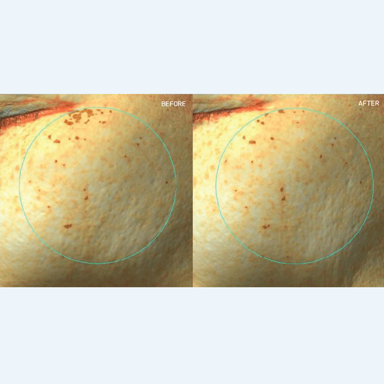 Regenerative 10B-EXO EGF Ampoule