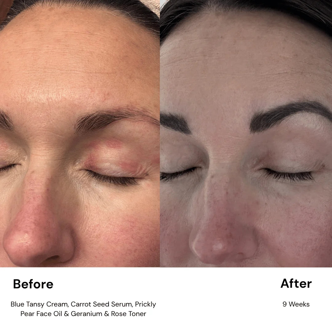 Carrot Seed Serum