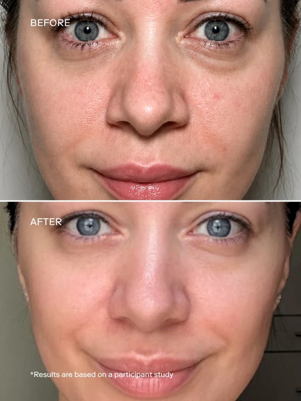 EXO ELITE™ Skin Longevity Serum